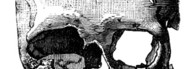 The Morgue Fissure Between Worlds